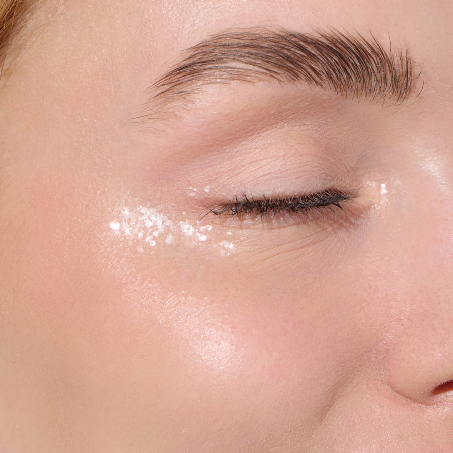 Person hat Birkenspanner Bio-Glitzer Snow Flake unterm Auge